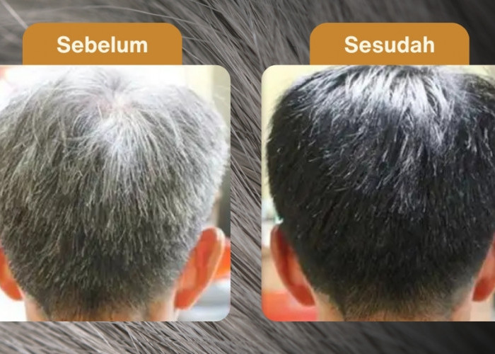 4 Bahan Alami Penghilang Uban dalam 1 Malam, Bikin Rambut Putih Jadi Hitam Permanen