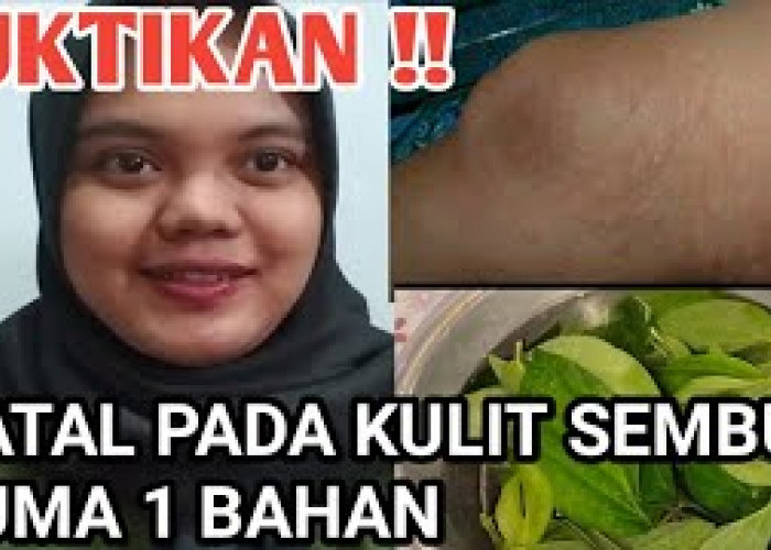 Ingin Sembuh dari Penyakit Kulit? Inilah 3 Manfaat Daun Sirih Merah untuk Penyakit Kulit