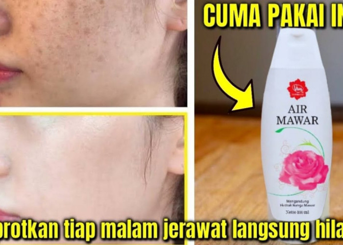 5 Cara Pakai Air Mawar Viva untuk Flek Hitam Paling Lengkap, Efektif Bikin Wajah Glowing dan Awet Muda