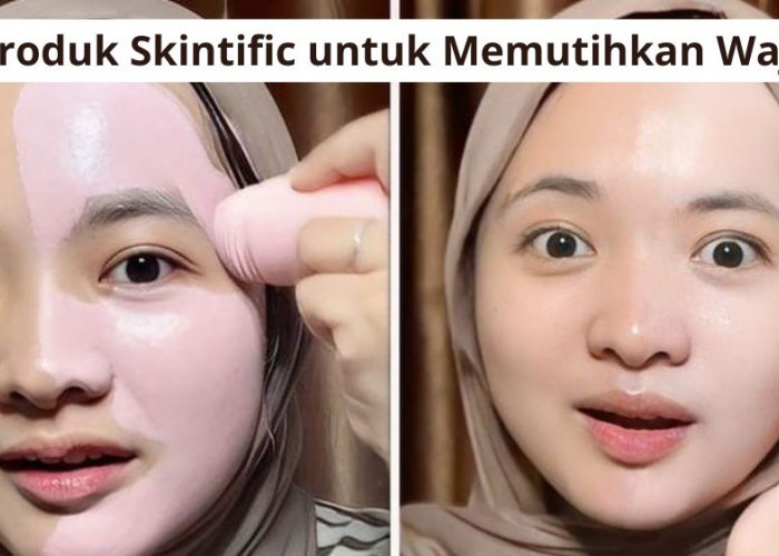 3 Rekomendasi Produk Skintific untuk Memutihkan Wajah, Bantu Atasi Kulit Kusam Agar Cerah Alami