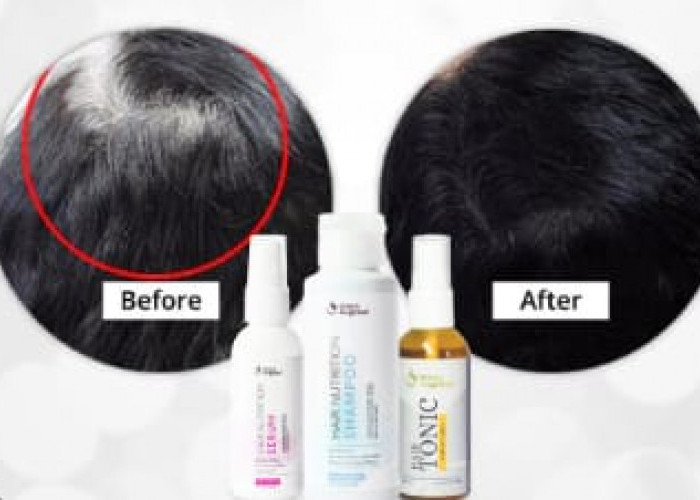 3 Minyak Rambut Penghilang Uban untuk Usia 40 Tahun Ke Atas, Rambut Hitam Permanen dalam Sekali Usap