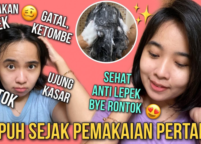 4 Shampo Anti Ketombe dan Gatal Terbaik, Rambut Jadi Bersih dan Sehat Tanpa Khawatir Rontok dan Botak
