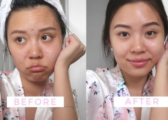 5 Tips Mudah Memilih Skincare untuk Kulit Sensitif, Pemula Wajib Tahu!