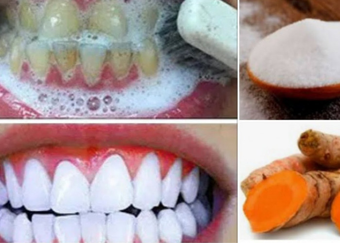 Inilah 5 Cara Menghilangkan Gigi Kuning dengan Bahan Alami Rumahan, Gigi Putih Lagi Tanpa Karang dan Bau Busuk