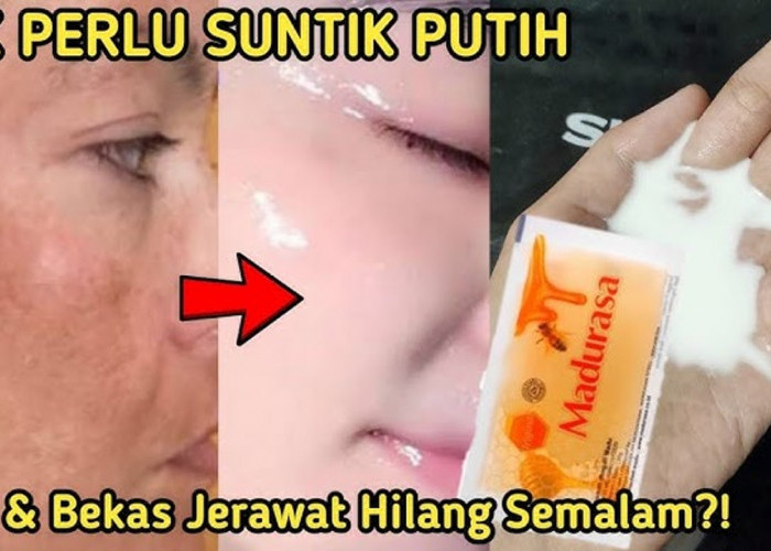 DIY Masker Madu untuk Mengelupas Flek Hitam dalam 1 Malam, Begini Cara Meraciknya