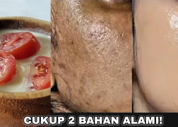 Tips Mengelupas Flek Hitam dalam 1 Malam dengan Masker Tomat, Begini Cara Meraciknya