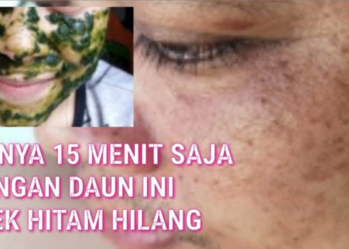 6 Daun Penghilang Flek Hitam Terbaik, Cara Alami Bikin Wajah Glowing Awet Muda Paling Mudah dan Aman