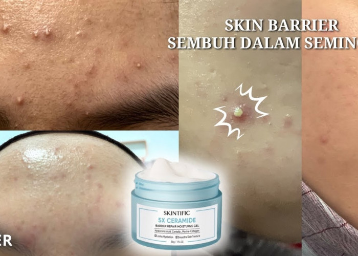 3 Produk Baru Skintific yang Bagus untuk Kulit Berminyak dan Berjerawat, Mampu Mencerahkan Kulit Gelap