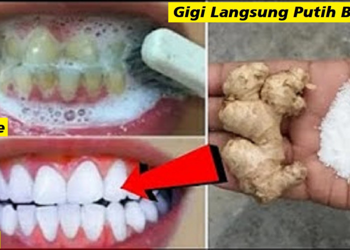 5 Cara Simpel Memutihkan Gigi Kuning yang Membandel Secara Alami, Gigi Putih Bersih Anti Karang dan Plak 