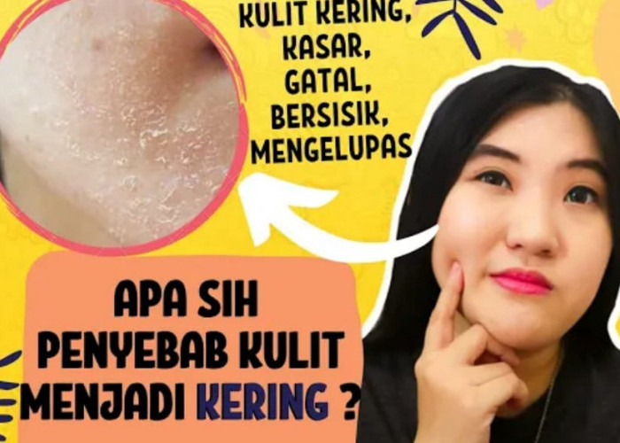 4 Cara Mengatasi Kulit Muka Mengelupas dengan bahan dapur, Wajah jadi Lembap, Kenyal dan Bebas Kerutan