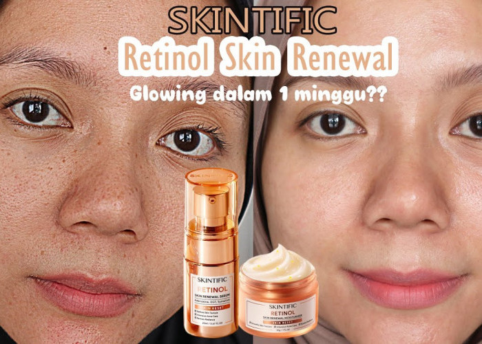 Review Hasil Pemakaian Retinol Skintific dalam 1 Minggu, Hasil Nyata Tanpa Iritasi!