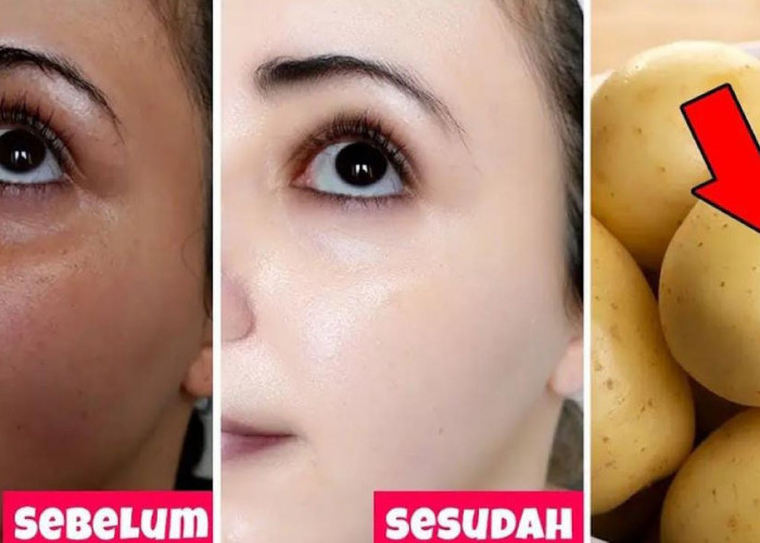 3 Cara Membuat Wajah Glowing Dengan Kentang, Ampuh Hilangkan Flek Hitam dan Kecilkan Pori-Pori