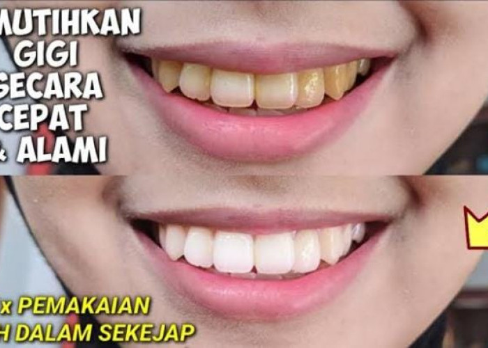 Begini 4 Cara Menggunakan Jeruk Nipis untuk Memutihkan Gigi dalam 1 Hari, Sikat Habis Plak dan Noda Kuning