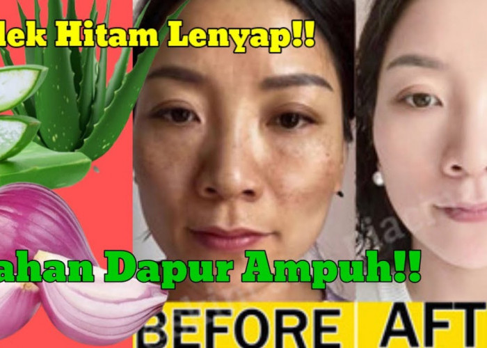 Rahasia Menghilangkan Flek Hitam di Wajah Secara Alami dan Cepat, Kulit Glowing Merata Hanya Pakai 5 Bahan ini