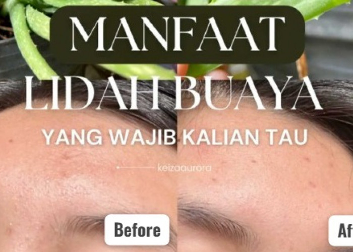 7 Manfaat Lidah Buaya untuk Wajah Kusam, Efektif Memutihkan dan Bikin Awet Muda Lengkap dengan Cara Pakainya