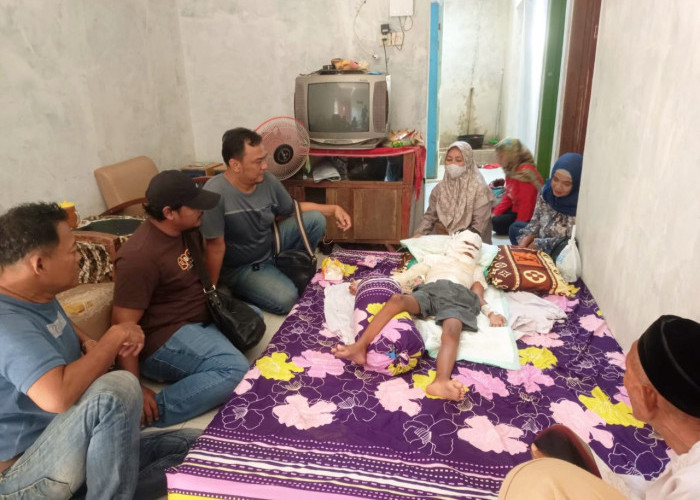 Komisi IV DPRD Batang Jenguk Bocah Luka Bakar, Minta Pemda Tanggung Biaya Perawatan hingga Sembuh