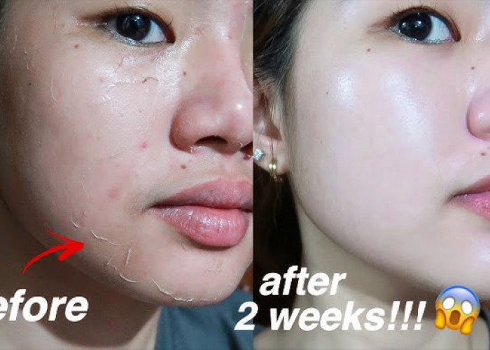 5 Skincare untuk Memutihkan Wajah dan Glowing yang Aman dan Sudah BPOM