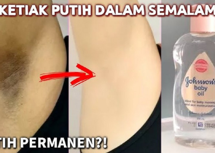 Cara Menghilangkan Ketiak Hitam Secara Alami, Pakai 3 Bahan Ini Kulit Ketiak Langsung Putih dan Kering