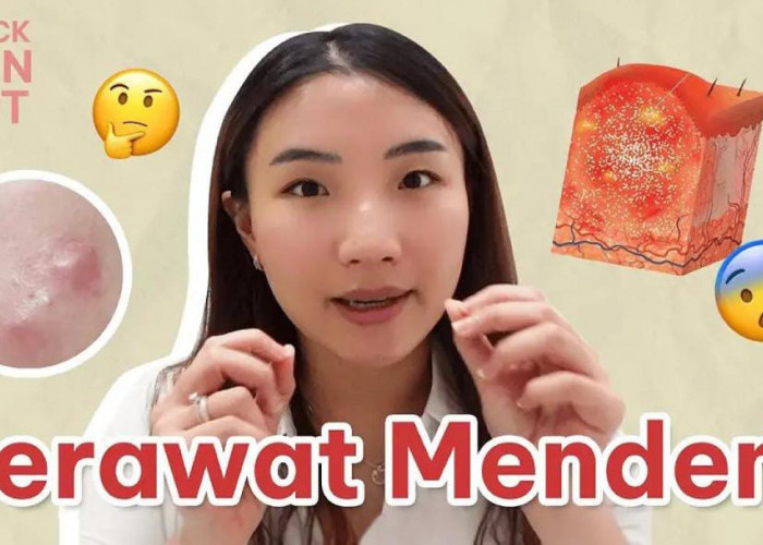 5 Metode Menghilangkan Jerawat Secara Alami Tanpa Modal Agar Kulit Mulus