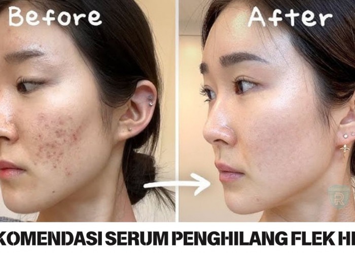 3 Rekomendasi Serum Penghilang Flek Hitam, Bikin Kulit Kencang Bebas Kerutan Langsung Glowing Sekali Pakai