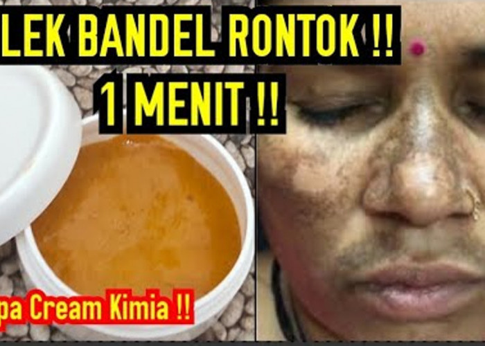 Ini Dia Cara Menghilangkan Hiperpigmentasi di Wajah Secara Alami, Cuma 3 Langkah