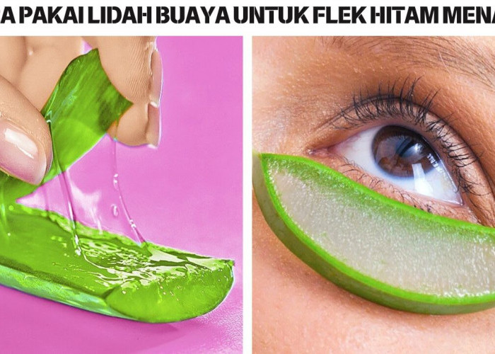 2 Cara Pakai Lidah Buaya untuk Flek Hitam Menahun, Cukup 1 Bahan Bikin Wajah Glowing dalam 1 Malam