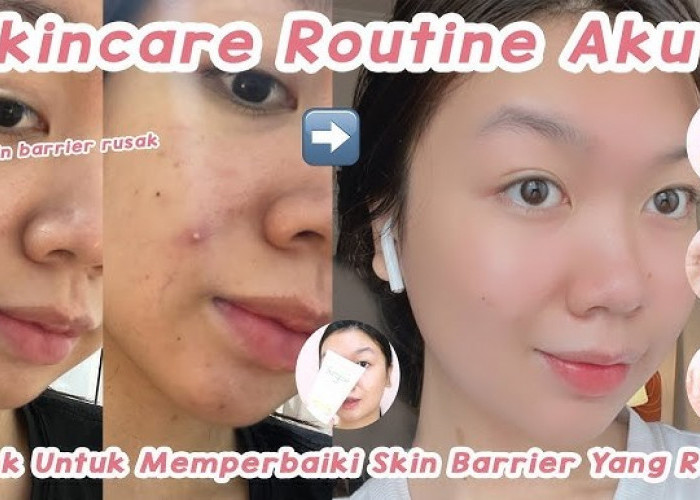 4 Merk Skincare untuk Skin Barrier yang Rusak, Bagus Nggak Sih?