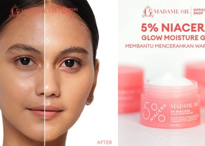 NEW LAUNCH! Review Madame Gie 5% Niacera Glow Moisture Gel, Bikin Wajah Lembap dan Cerah Sekaligus