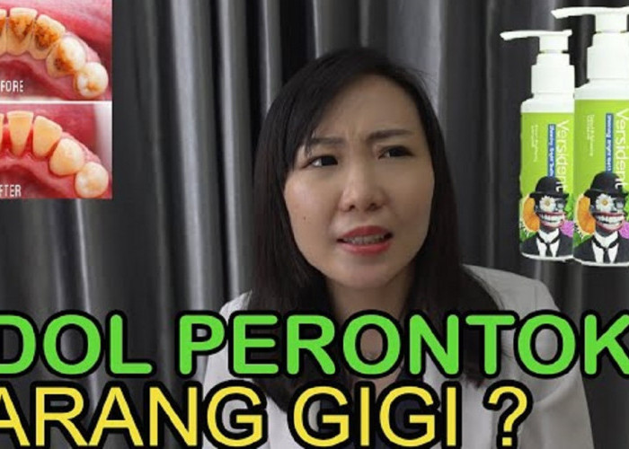 4 Merek Pasta Gigi yang Ampuh Menghilangkan Karang Gigi Membandel dalam 1 Malam, Gigi Putih Bersih Anti Karang