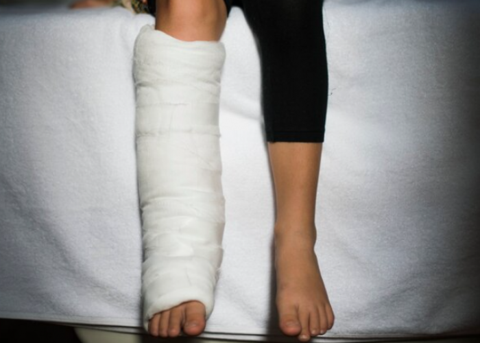 Cegah Resiko Komplikasi Patah Tulang pada Penderita Diabetes, Harus Rajin Cek Gula Darah Rutin