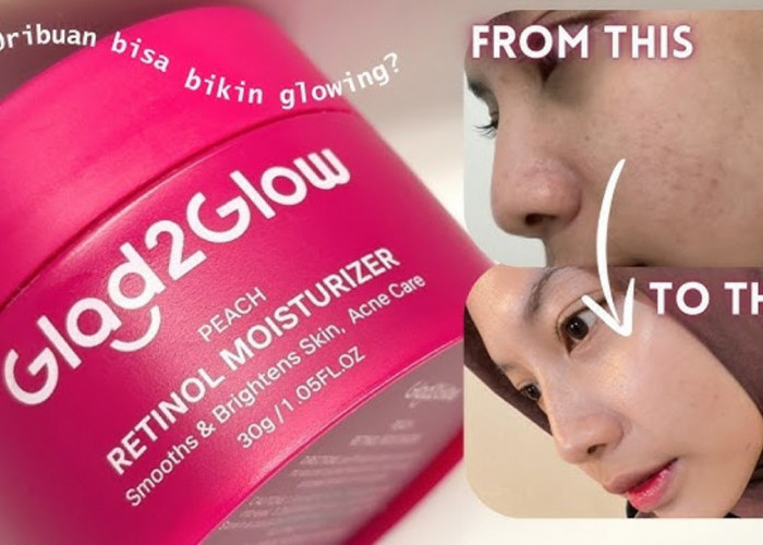 4 Produk Glad2Glow Khusus Menghilangkan Flek Hitam, Wajah Auto Glowing!