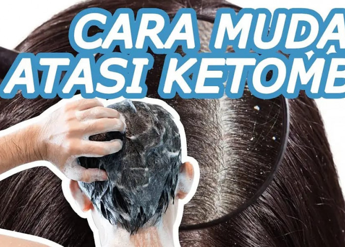 4 Cara Menghilangkan Ketombe Secara Alami Agar Tidak Muncul Lagi Permanen