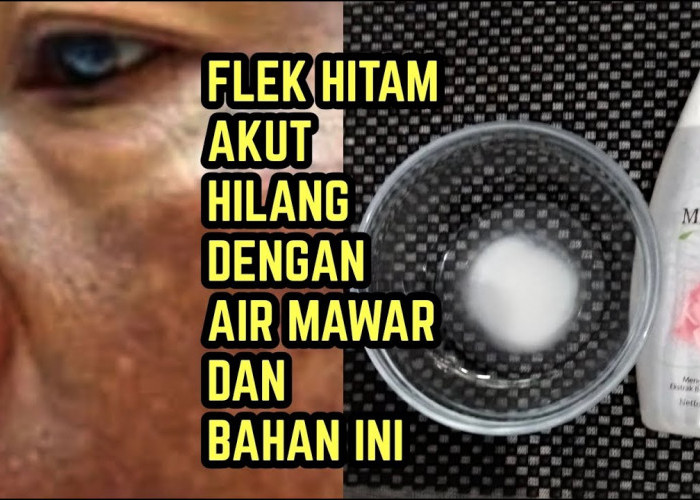 DIY Racikan Air Mawar Penghilang Flek Hitam, Tambahkan 1 Bahan Ini Wajah Glowing dalam 1 Malam