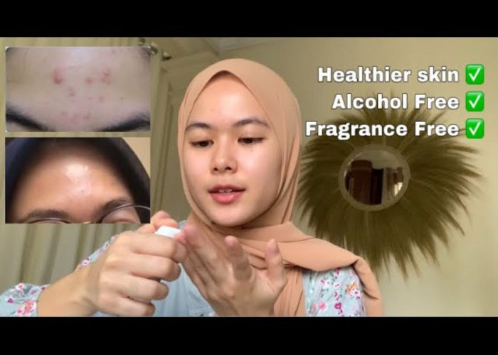 Rekomendasi Moisturizer Tanpa Fragrance yang Cocok Digunakan Kulit Sensitif dan Ibu Hamil