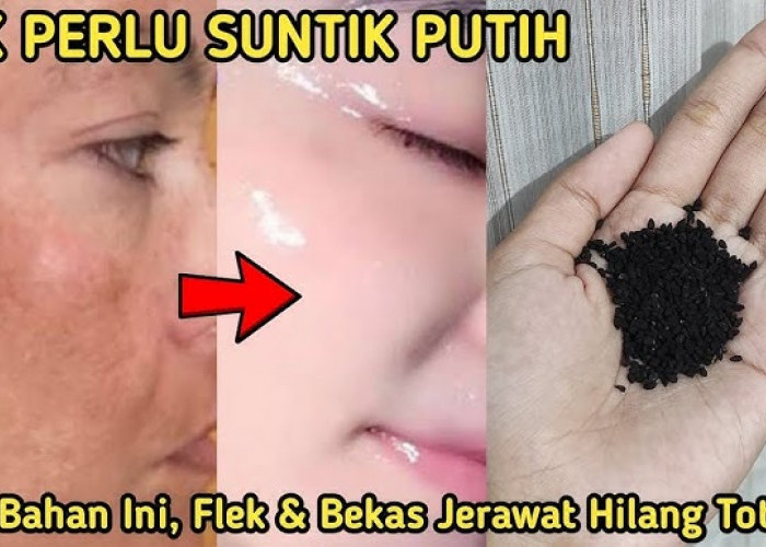 4 Bahan Alami Pengelupas Flek Hitam dalam 1 Malam, Wajah Glowing Keesokan Harinya