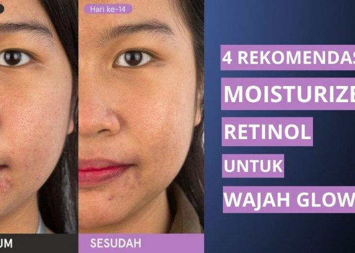 4 Rekomendasi Moisturizer Retinol untuk Wajah Glowing dan Mulus, Bantu Memperbaiki Kerusakan Kulit