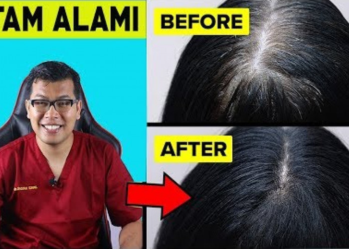 3 Manfaat Minyak Kayu Putih untuk Uban dan Cara Pakainya yang Efektif Hitamkan Rambut Dalam Sekali Oles!