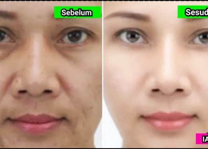 4 Skincare BPOM Tanpa Merkuri yang Ampuh Memutihkan Wajah, Rahasia Kulit Mulus Bebas Noda Hitam dan Pori Besar