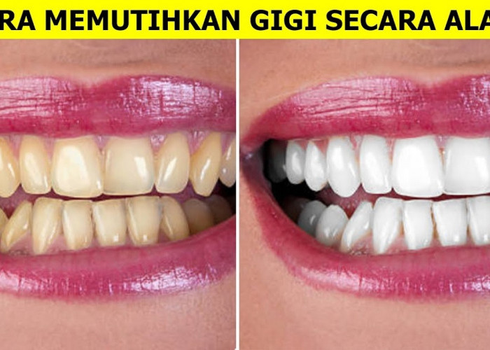 3 Bahan Alami untuk Memutihkan Gigi Kuning Secara Alami dan Cepat, Tips Ampuh Putihkan Gigi Bebas Plak Kuning