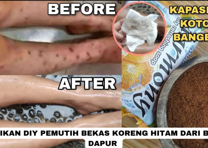 3 Racikan DIY Pemutih Bekas Koreng Hitam Dari Bahan Dapur, Kulit Langsung Putih Cukup Tambah 1 Bahan Ini