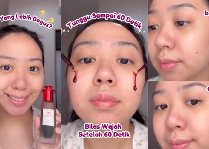 Battle Review Peeling Solution Viral antara Skintifiv Vs Elfromula, Mana yang Paling Bagus?