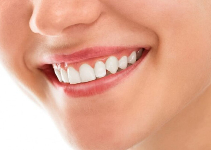 Begini 4 Cara Agar Karang Gigi Lepas Sendiri Dengan Cepat Secara Alami yang Mudah, Gigi jadi Putih dan Bersih