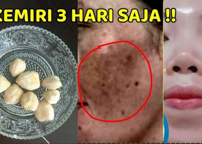 Begini Cara Membuat Masker Kemiri untuk Wajah Glowing yang Aman, Cuma 3 Langkah