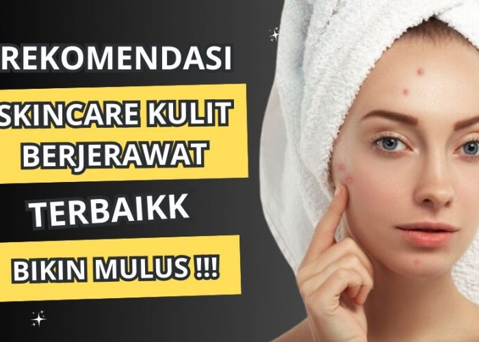 4 Rekomendasi Skincare untuk Kulit Berjerawat yang Bikin Mulus, Nyaman di Wajah