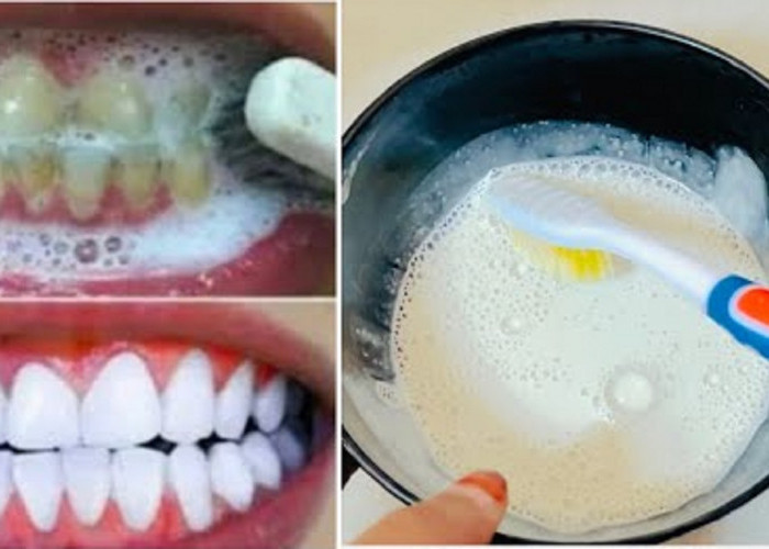 3 Cara Mengatasi Gigi Kuning dengan Bahan Alami, Bisa Rontokkan Karang dan Plak Secara Permanen Anti Bau Mulut
