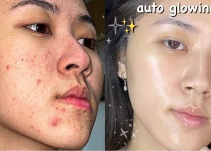 5 Penyebab Wajah Tetap Kusam Meskipun Pakai Skincare, Apa Saja?