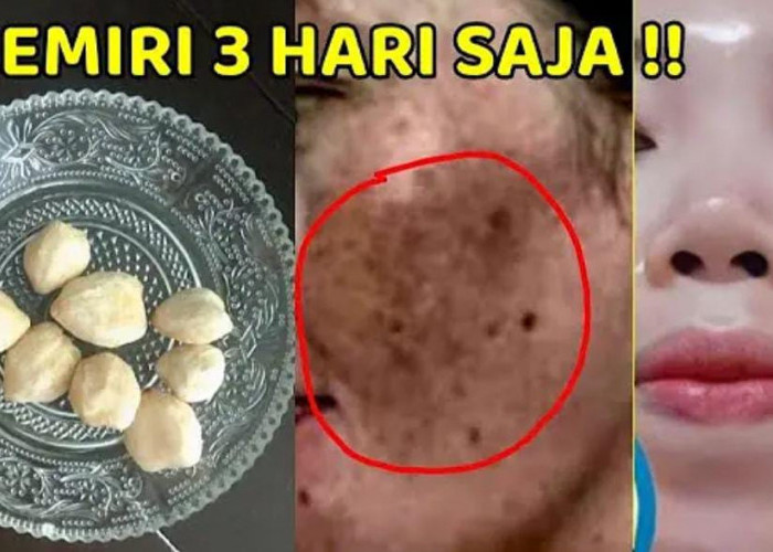 Tips Pakai Minyak Kemiri untuk Wajah Agar Bebas Penuaan Dini dan Flek Hitam