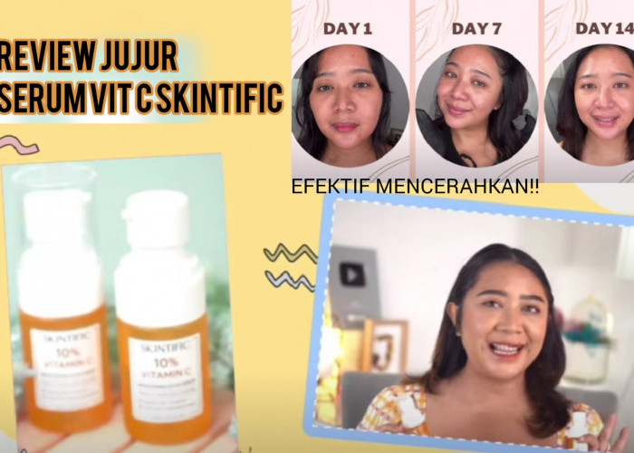 Review Jujur Skintific Serum Vit C Ampuh Bikin Wajah Glowing dan Flek Hitam Hilang, Kulit Putih dalam 2Minggu!