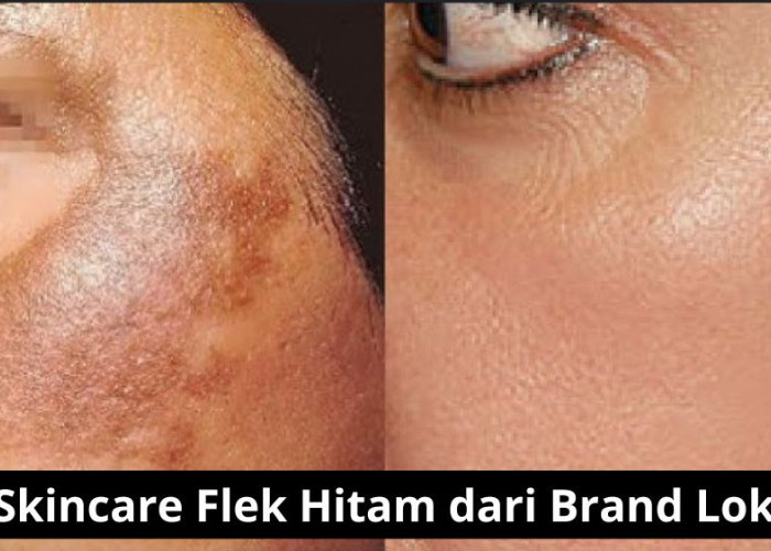 4 Skincare Flek Hitam dari Brand Lokal, Rekomendasi Terbaik untuk Wajah Glowing dan Awet Muda