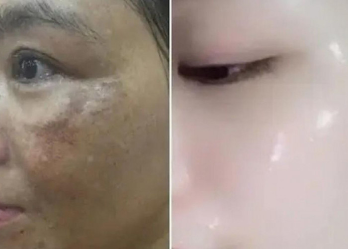 2 DIY Masker Bengkoang untuk Menghilangkan Flek Hitam dan Memutihkan Wajah, Bikin Kulit Glowing!